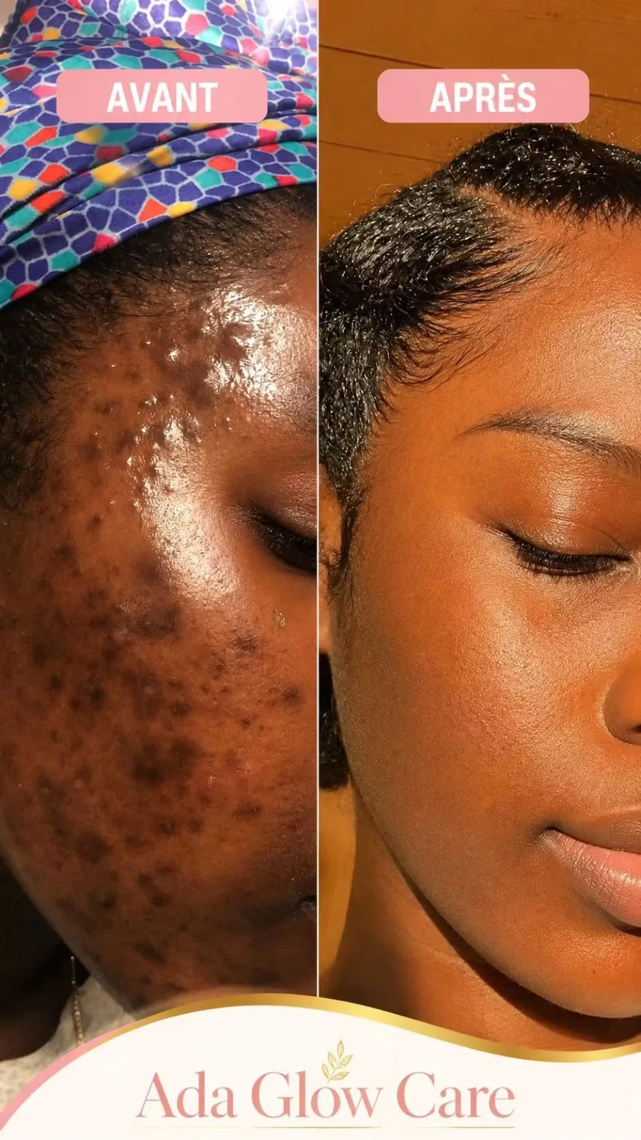 Soins de visage