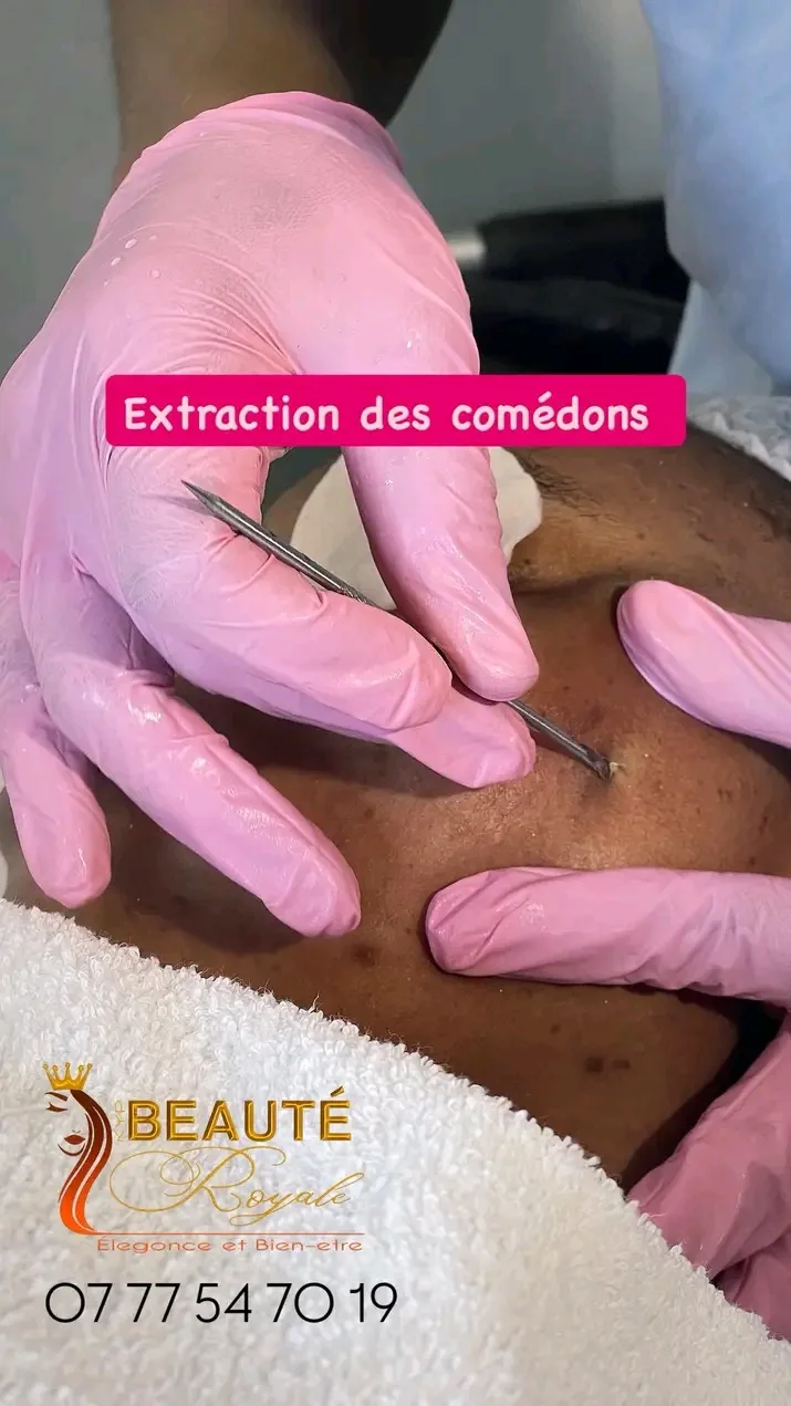 Exécution d'amidon